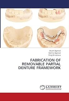 FABRICATION OF REMOVABLE PARTIAL DENTURE FRAMEWORK